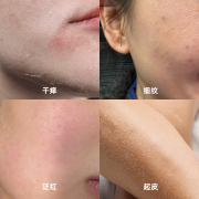 换季干皮必备 | hfp牛油果面霜伴你滋润稳稳过冬